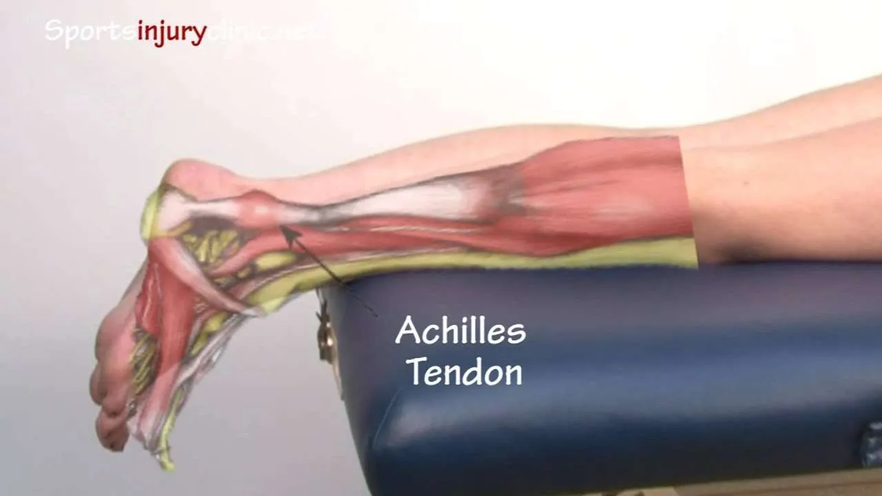 Tendinitis/tendinopatía de Aquiles: explicada en 90 segundos