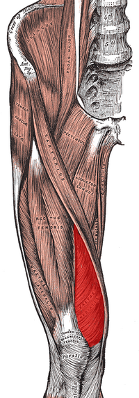Desecho medial oblicuo