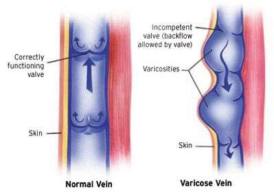 Anatomía de la válvula venosa.jpg