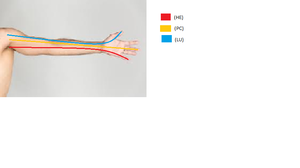 Brazo anterior 1.png