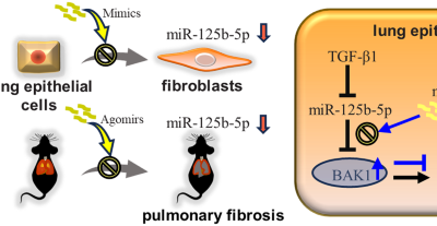 MiR-125b-5p alivia la fibrosis pulmonar al inhibir la transición epitelial-mesenquimatosa mediada por TGFβ1 al apuntar a BAK1