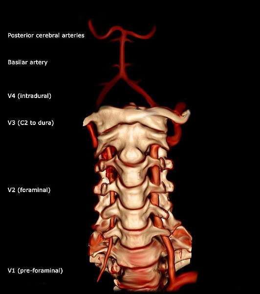 arteria vertebral