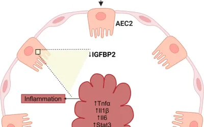 Célula epitelial alveolar La pérdida específica de IGFBP2 activa la inflamación en Covid-19
