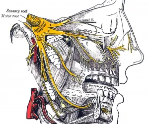 Neuralgia del Trigémino