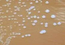 Tularemia