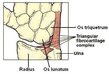 Lesiones del complejo de fibrocartílago triangular